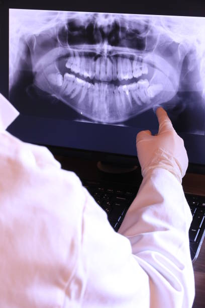 Best Emergency Dental Surgery in Buffalo, MO
