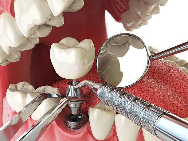 Best Weekend Emergency Dentist in Buffalo, MO